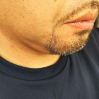 profile_image